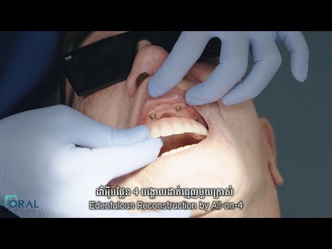 our patient's onial