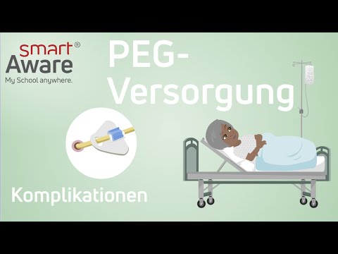 PEG-Versorgung: Komplikationen | Fachfortbildungen Pflege | Fortbildungen Pflege | smartAware