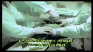 Autópsia alienígena soviética - Operação Sverdlovsk Midget