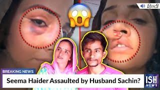 Seema Haider Assaulted by Husband Sachin?