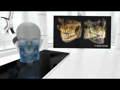 Tomografía Computada Cone Beam Carestream CS 9300 (Inglés)