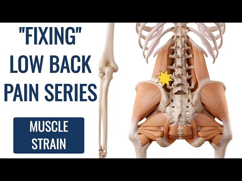 How to Fix Lower Back Strain (DON'T STRETCH)