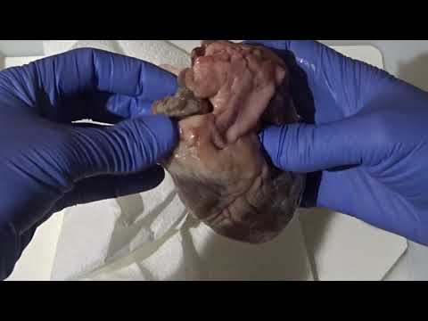 vidéo 2 dissection coeur orientation coeur Ventricule Droit