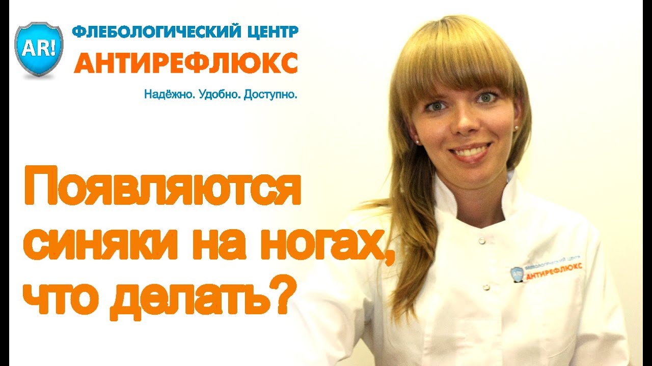 Появляются синяки на ногах, что делать