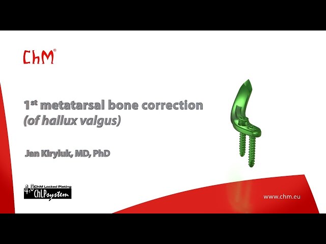Video Pronunciation of hallux valgus in English