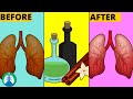 How to Cleanse Your Lungs with Cinnamon Oil