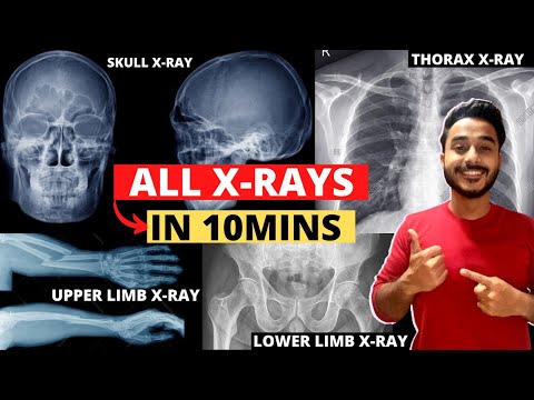 radiology anatomy | upper limb x ray anatomy viva | thorax x-ray anatomy practical | skull radiology