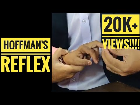 Hoffmann's Sign or Reflex