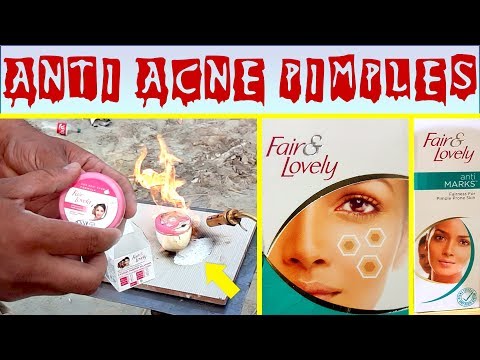 Bye Bye Acne & Pimples with Most Popular Fairness & Skin Whitening Cream, Fair & Lovely Review Hindi Video