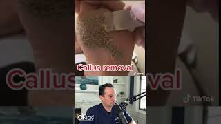 Download lagu REAKSI DOKTER TERHADAP PENGANGKATAN KALUS! 😱 #shorts #reaksi mp3 Download lagu REAKSI DOKTER TERHADAP PENGANGKATAN KALUS! 😱 #shorts #reaksi mp3