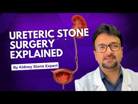 URS ~ URETERIC STONE SURGERY EXPLAINED | Urosurgeon Dr Dhanuka
