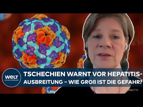 HEPATITIS: Tschechien warnt vor Ausbreitung – Wie gefährdet ist Deutschland?