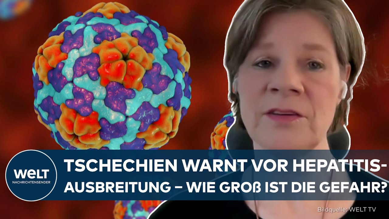 HEPATITIS: Tschechien warnt vor Ausbreitung – Wie gefährdet ist Deutschland?