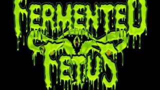Fermented Fetus - Gangrene Scrotum