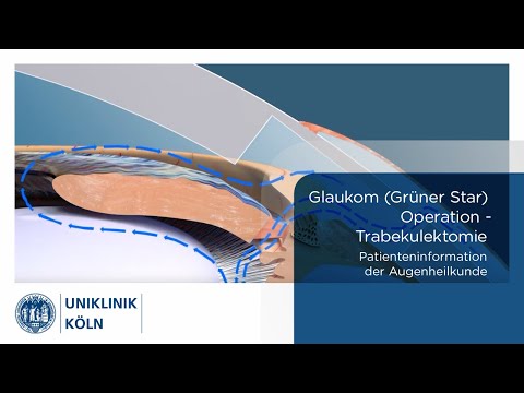 Grüner Star - Glaukom - Trabekulektomie