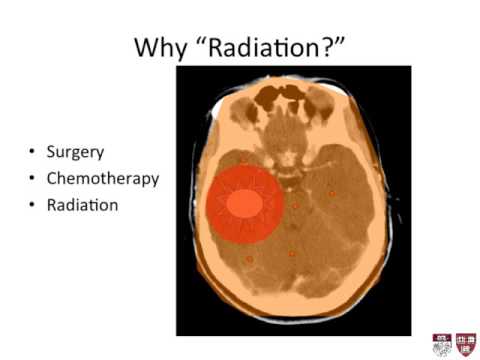 Lecture 1 - Introduction to Radiation Oncology