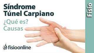 Síndrome del túnel carpiano - Qué es, causas, síntomas y tratamiento