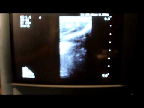 2101 Falcon B K Medical Machine