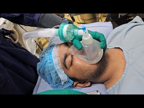 Live anesthesia #15#PLID#F&D#general anesthesia.