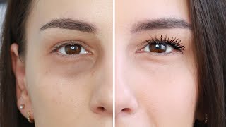 Augenringe abdecken - die besten SOS Tipps