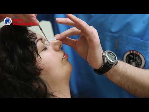 Kapalı (İzsiz) Burun Estetiği Ameliyatı - İzmir Ekol Hastanesi
