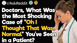 Doctors, What’s the Dumbest Case of “Oh I Thought That Was Normal” You’ve Seen?