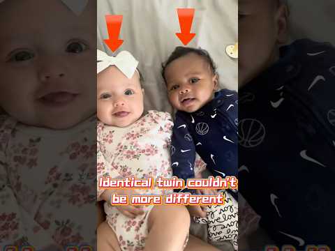 These twins are completely different 😱#shorts