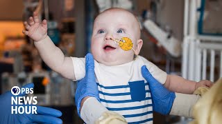 Breakthrough gene editing treatment helps child born with rare disorder