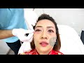 ร้อยไหม