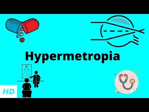 Látás szem myopia hyperopia asztigmatizmus