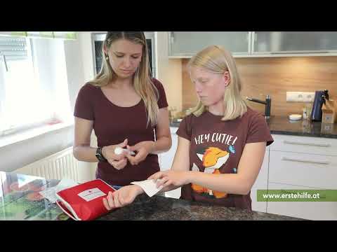 Kindernotfälle: Einem Kind helfen, das sich verbrannt hat