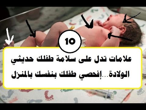 , title : '10 علامات تدل على سلامة طفلك حديثي الولادة ( إفحصي طفلك بنفسك بالمنزل )'