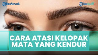 Cara Mengatasi Kelopak Mata Kendur dengan Foxy Eyes Treatment, Simak Ulasan dr Vivi Indrayanti