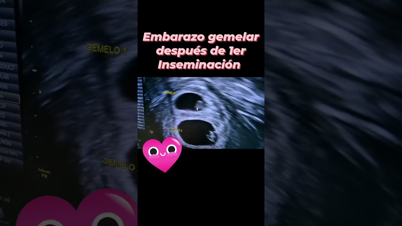 Edali Lara Rangel-43