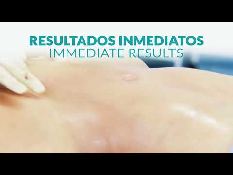 LIPOSUCCIÓN DE ALTA DEFINICION