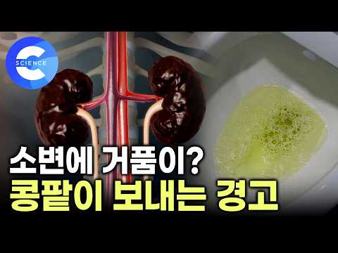몸이 붓고 피곤하다면? 콩팥병 신호 | 소변에 거품이 생기면 이미 콩팥병 진행 중 | 콩팥병 예방하는 식습관