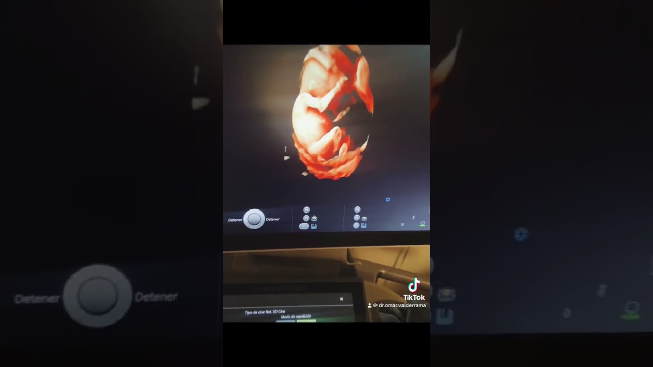 Omar Valderrama Loyola-24