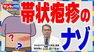 帯状疱疹のナゾ
