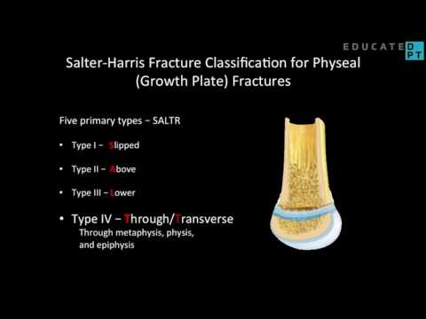 Salter Harris Fracture Classification for Growth Plate Fractures