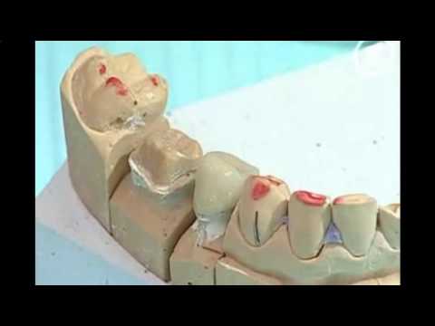 Сколько стоит поменять суставы Смертельные болезни суставов