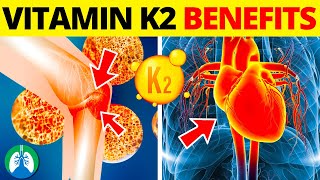Download the video "Top 10 Health Benefits of Vitamin K2 That You MUST Know"