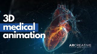 3D Medical Animation - Arcreative Highlights (Demo