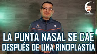 La punta de la nariz SE CAE después de una RINOPLASTÍA  | PlasticFacial MX
