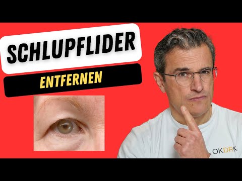 👁️ Schlupflider adé! Alles, was Sie über die OP wissen müssen 👁️