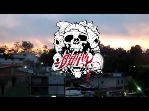 $ause+Parkinzon (Oficial preview)