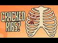 Cracked & Broken Ribs: Symptoms, Treatment, & Recovery Time.