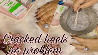 Get rid of Cracked heels permanently ! Magical remedy for cracked, rough and dry feet.