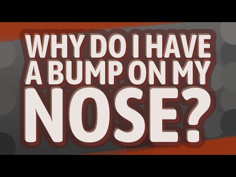 Why do I have a bump on my nose?