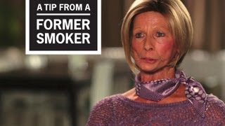 CDC: Tips From Former Smokers - Terrie H.: “Terrie, What Are You Doing?”