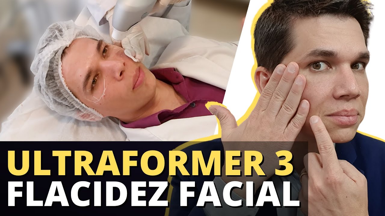 ULTRAFORMER 3: Tratando Flacidez da Pele e Gordura Localizada
